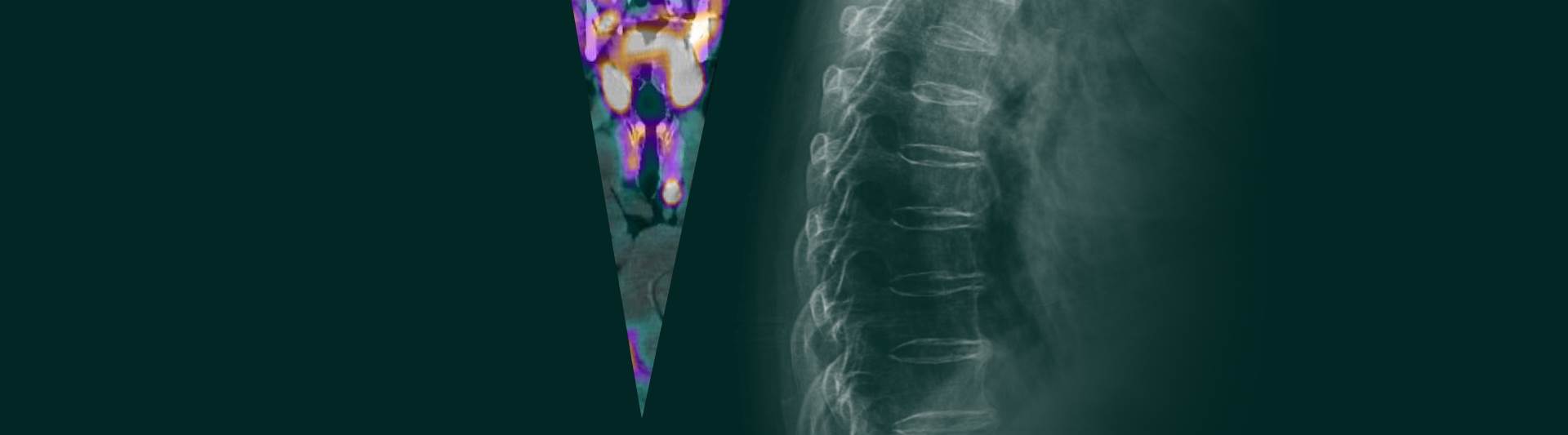 Osteoporosis, Thyroid & Parathyroid Diseases 2024